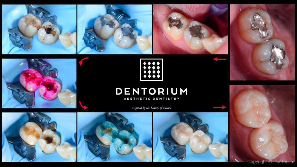 aestethic reconstruction