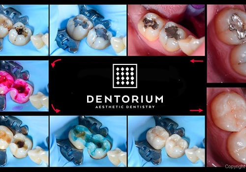 aestethic reconstruction